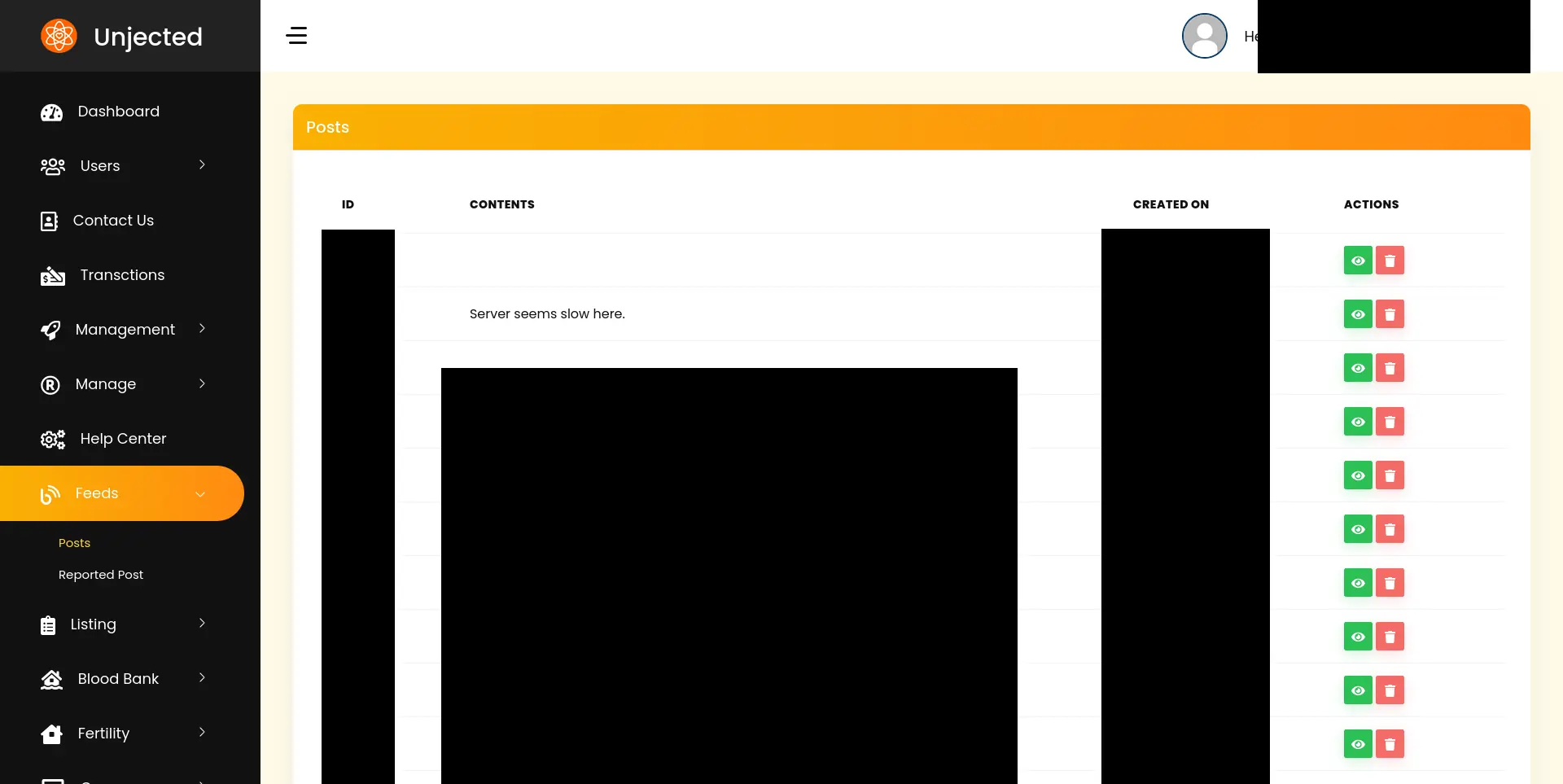 Screenshot of the dashboard. There's a sidebar on the left with the following items: Dashboard, Users, Contact Us, Transactions, Management, Manage, Help Center, Feeds, Listing, Blood Bank, Fertility. The Feeds item is selected which has two sub items: Posts (selected), Reported Post. Each sidebar item has a related icon on its left. At the top of the sidebar theres the unjected logo and on its left the word 'Unjected'. On the main panel theres a table with the title of 'Posts' and header items: ID, CONTENTS, CREATED ON, ACTIONS. All the table bodies are censored except for one with the content of 'Server seems slow here. Each row of the action column has 2 buttons: a green one with an eye icon and a red one with a trash car icon.'